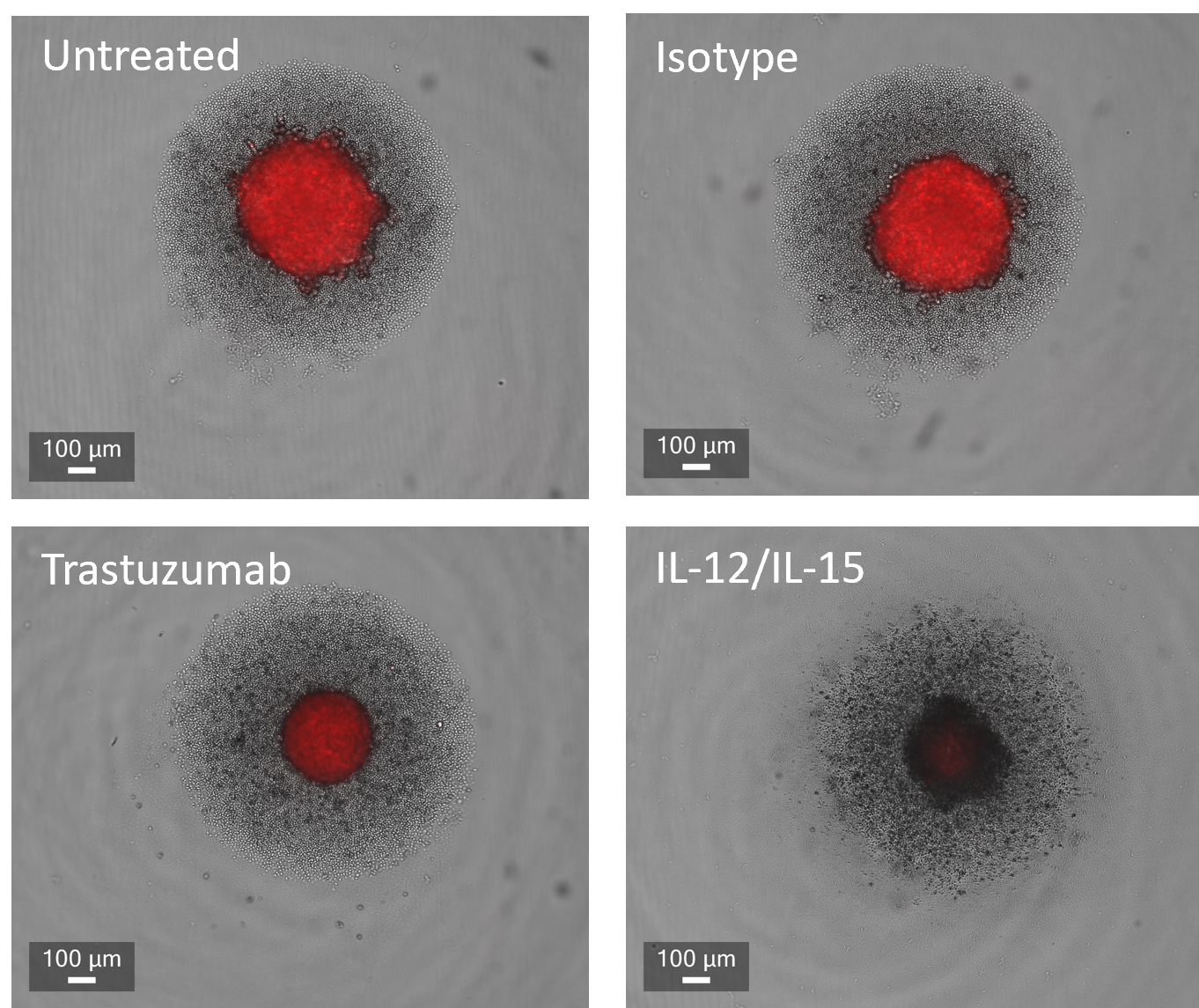 3D Tumour killing models: tool for screening immune therapeutics